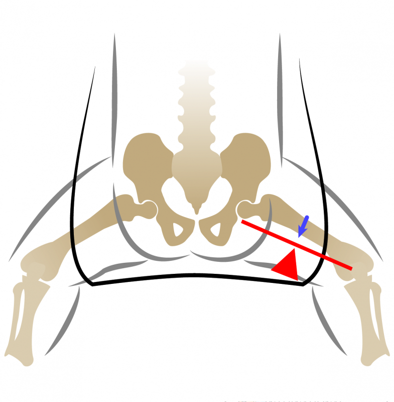 Displasia dell'anca: la terapia 