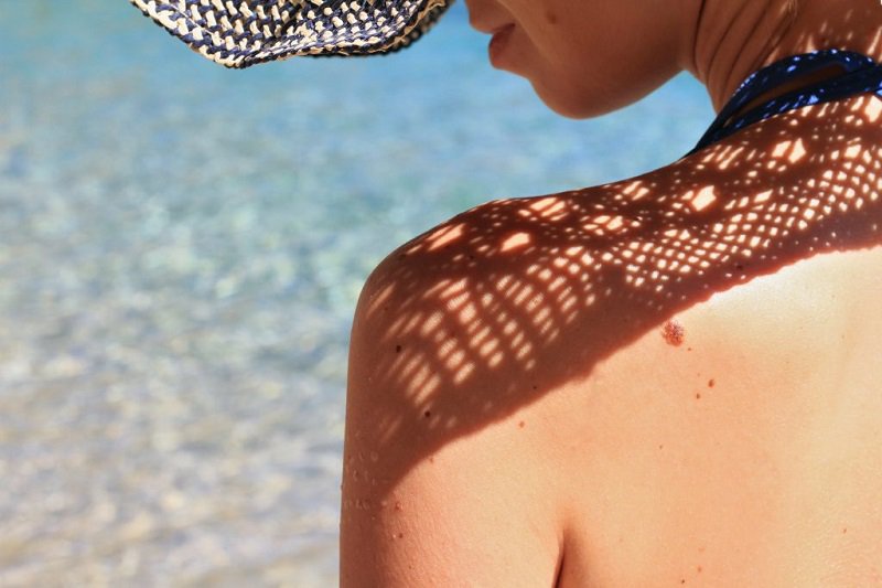 MELANOMA, sole e buone abitudini