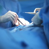 Angiologia/Chirurgia vascolare