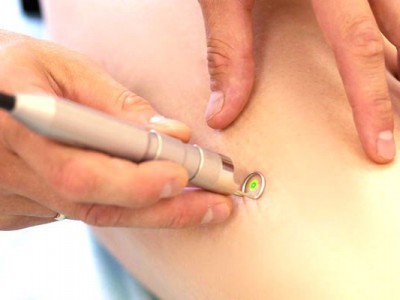 Angiologia/Chirurgia vascolare