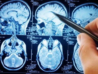 Neurologia