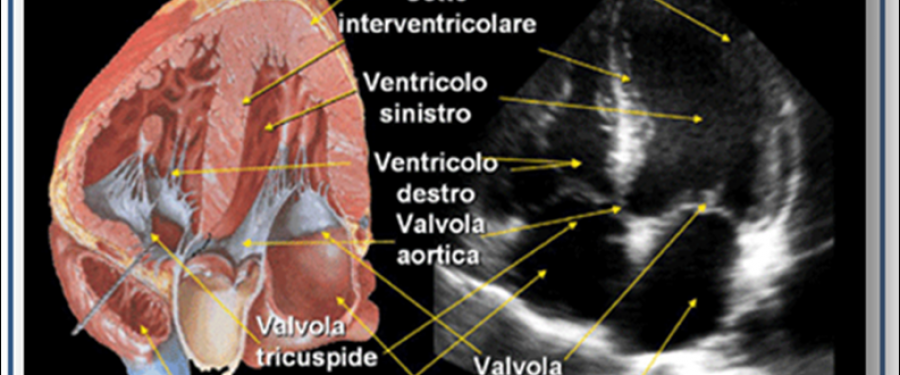 Che cos'è l'ecocardiogramma?