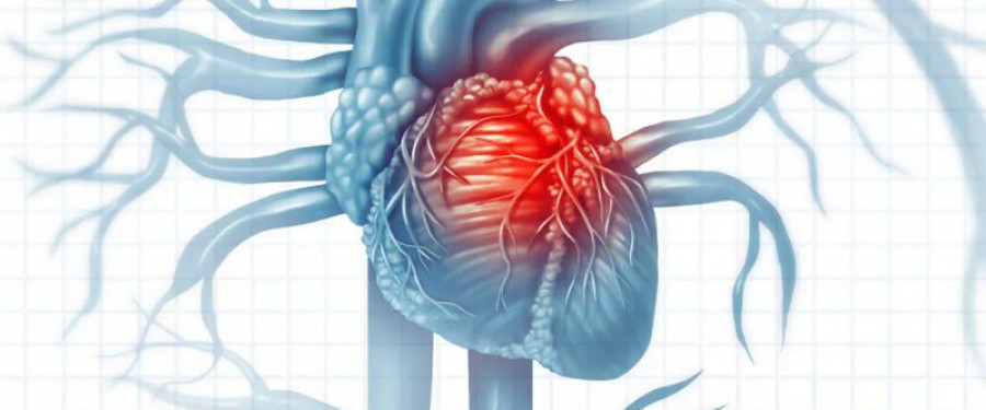 Patologie cardiovascolari: fattori di rischio, sintomi, diagnosi, prevenzione e cura