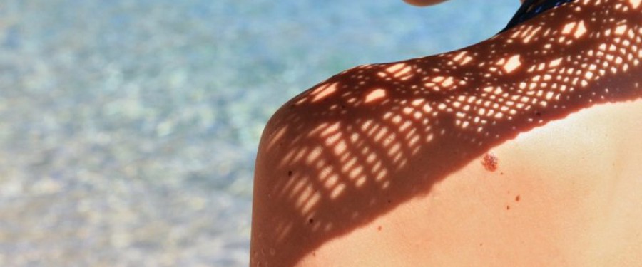 MELANOMA, sole e buone abitudini