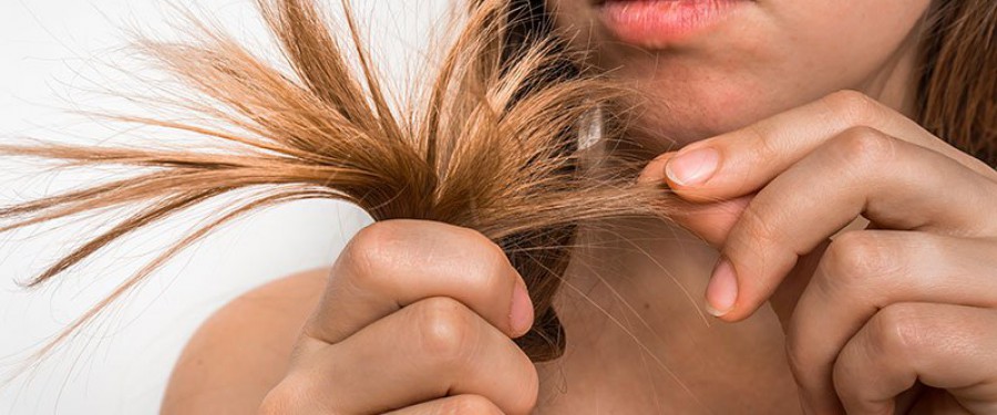 I problemi di perdita di capelli